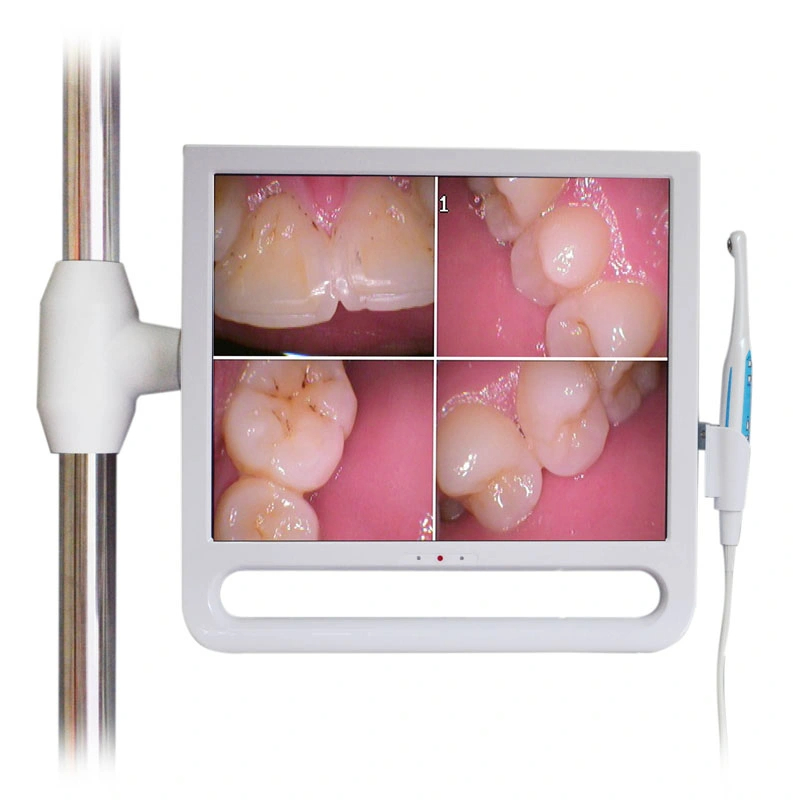 YF1700M 17 Inch Professional Dental Intraoral Camera with Monitor & Bracket Holder 1024*768 Pixels image 2