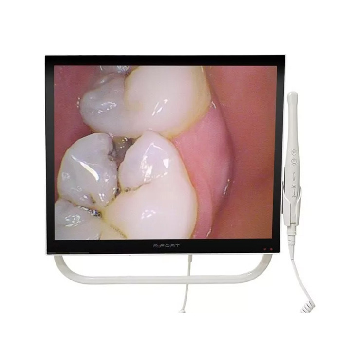 Magenta YFHD-D Professional Dental Intraoral Camera 1/4 Sony CCD 17 Inch Monitor & Support Arm Bracket image 2