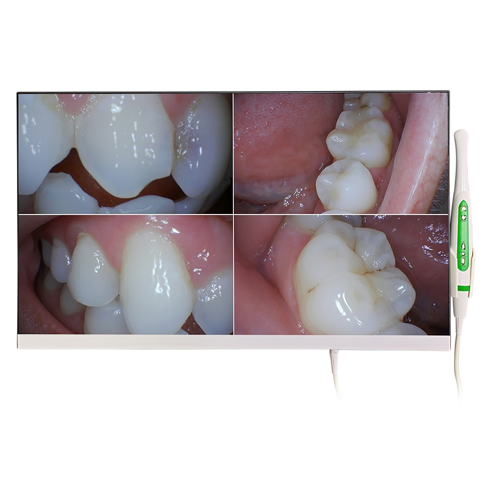 Magenta YF-2400M Wifi Professional Dental Intraoral Camera with 24 Inch Monitor & Iron Bracket image 2