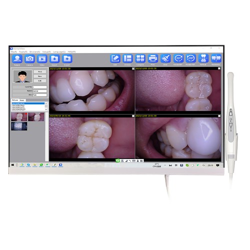 Magenta YF-2400P 24 Inch Touch Screen Intraoral Camera with LCD Monitor & Wifi Function for Professional Use image 1