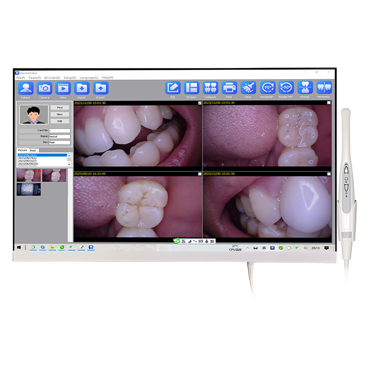 Magenta YF-2400P 24 Inch Touch Screen Intraoral Camera with LCD Monitor & Wifi Function for Professional Use image 2