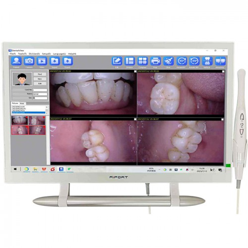 Magenta YF-2200P with 21.5 Inch LCD Monitor Touch Screen Intraoral Camera VGA and HDMI image 1