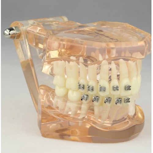 Professional Dental Orthodontic Model with Ceramic Brackets M3009