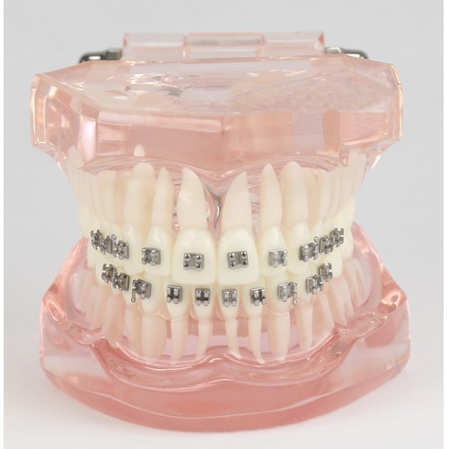 Professional Dental Teeth Malocclusion Correct with Metal Bracket Standard Model M3001