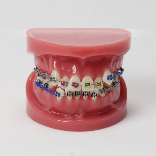 Professional Dental Teeth Malocclusion Correct with Teeth Bracket Standard Model M3005