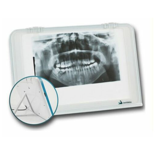 HISHINE® Professional Dental Luna X-Ray Film Reader LED Specific Wall Desk Mounting image 3