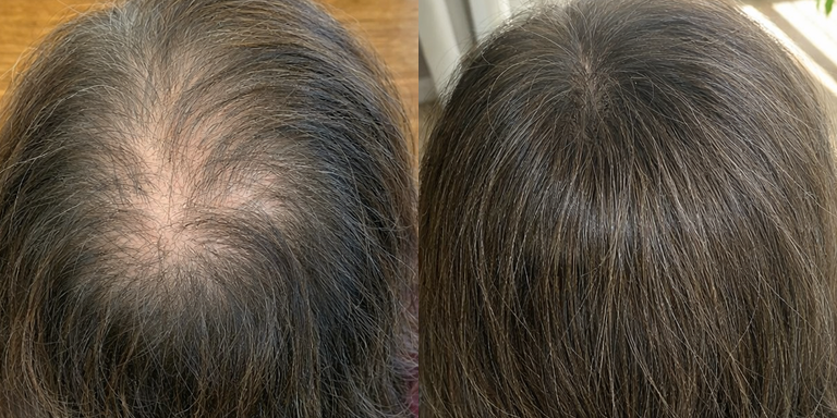 Red light scalp care cap detail 4