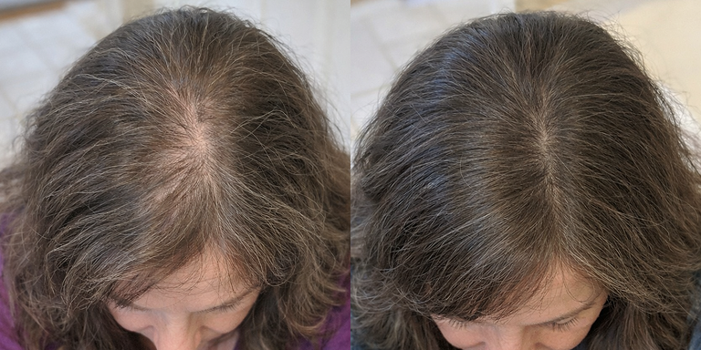 Red light scalp care cap detail 5