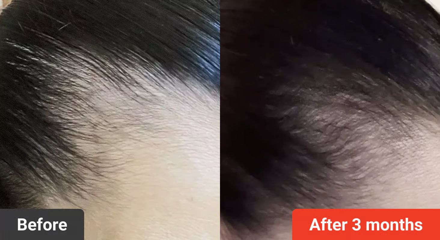 Red light scalp care cap detail 6
