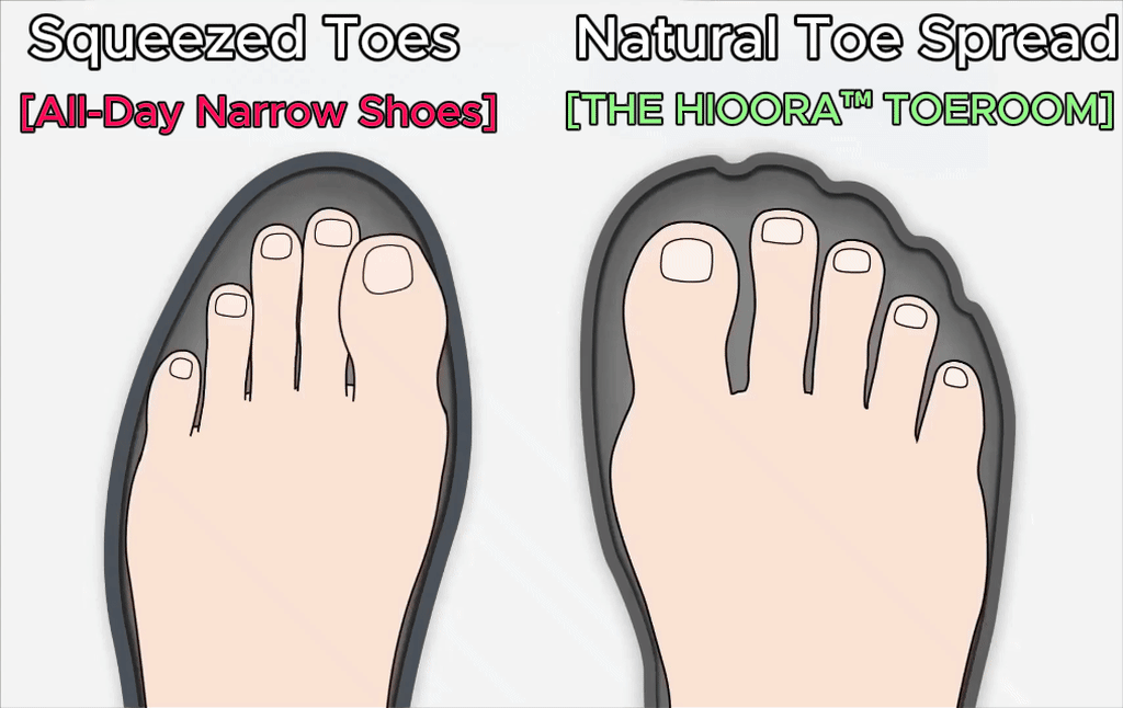 Natural toe spread