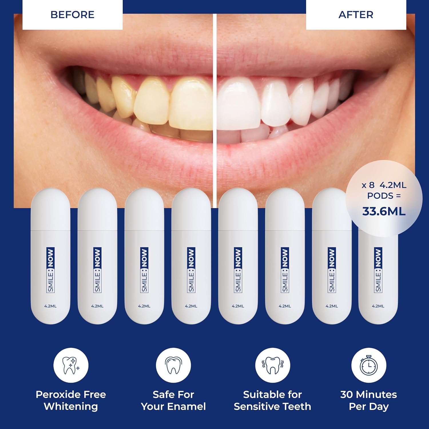 Kit de albire a dintilor - Albitor de dinti Papanicolau Formulat de stomatologi din Marea Britanie - 8 capsule de gel de albire a dintilor 33,6 ml Gel de albire a dintilor Smile de inalta vizibilitate