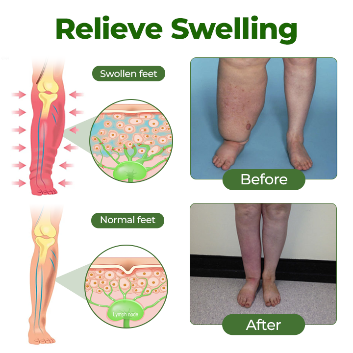 gvahq® Professional Leg Circulation Cream — 6