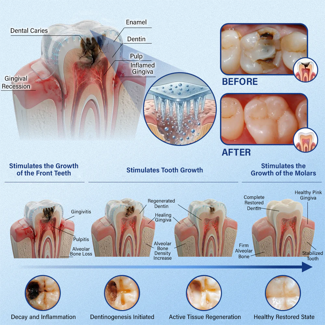 gvahq® Tooth & Gum Repair Fast-Dissolving Microneedle Patch — 6