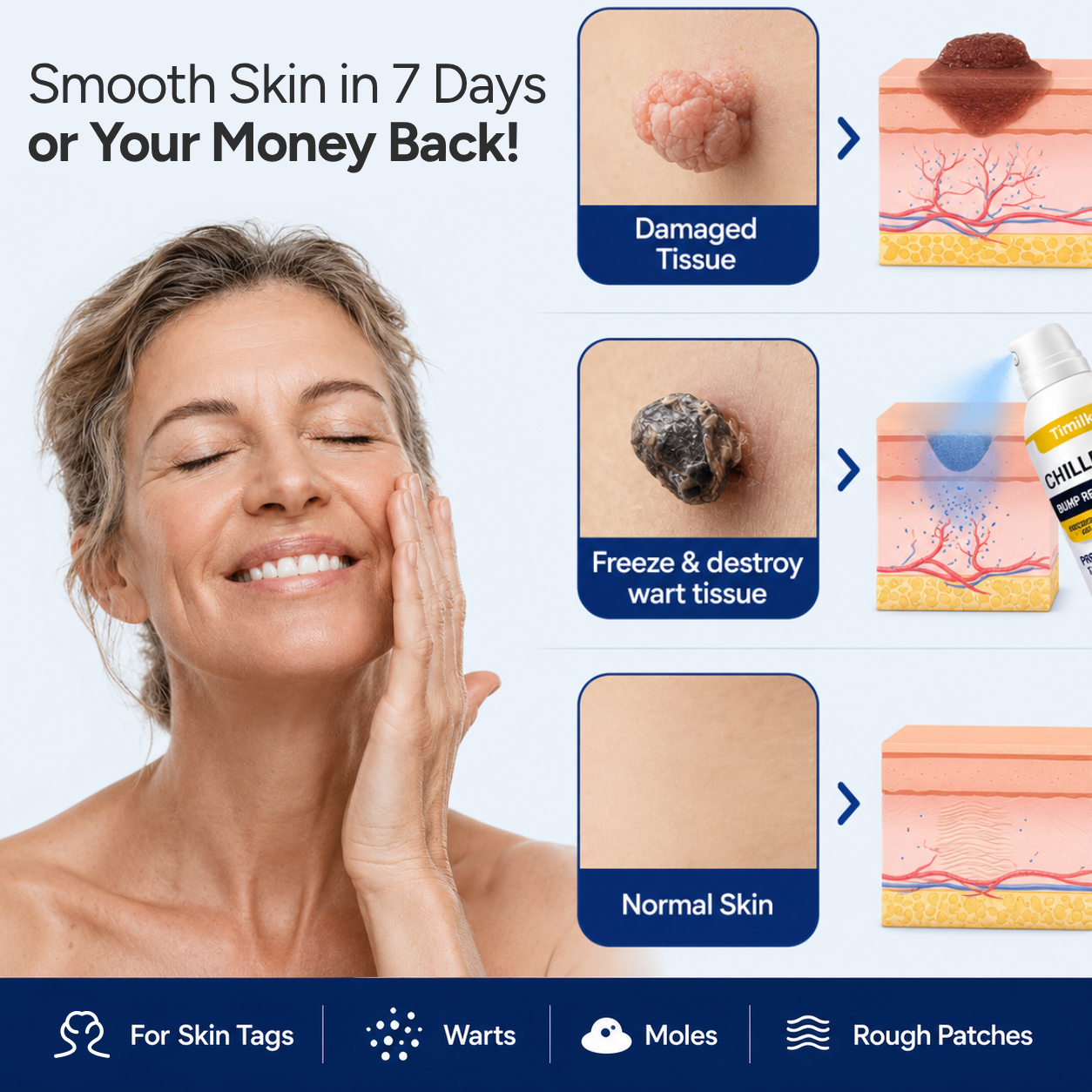 gvahq® Overnight Skin Tag Spray — 6