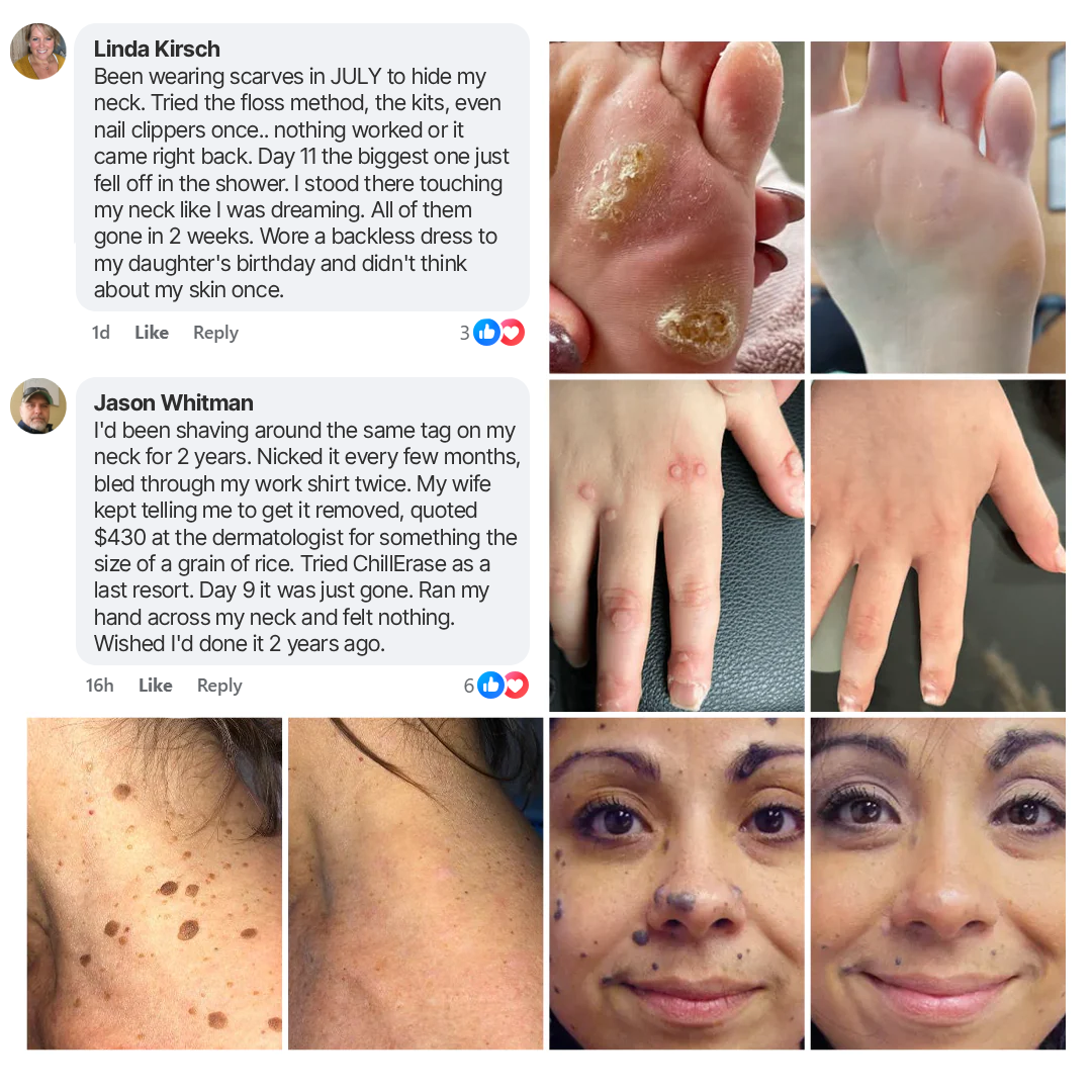 gvahq® Overnight Skin Tag Spray — 2