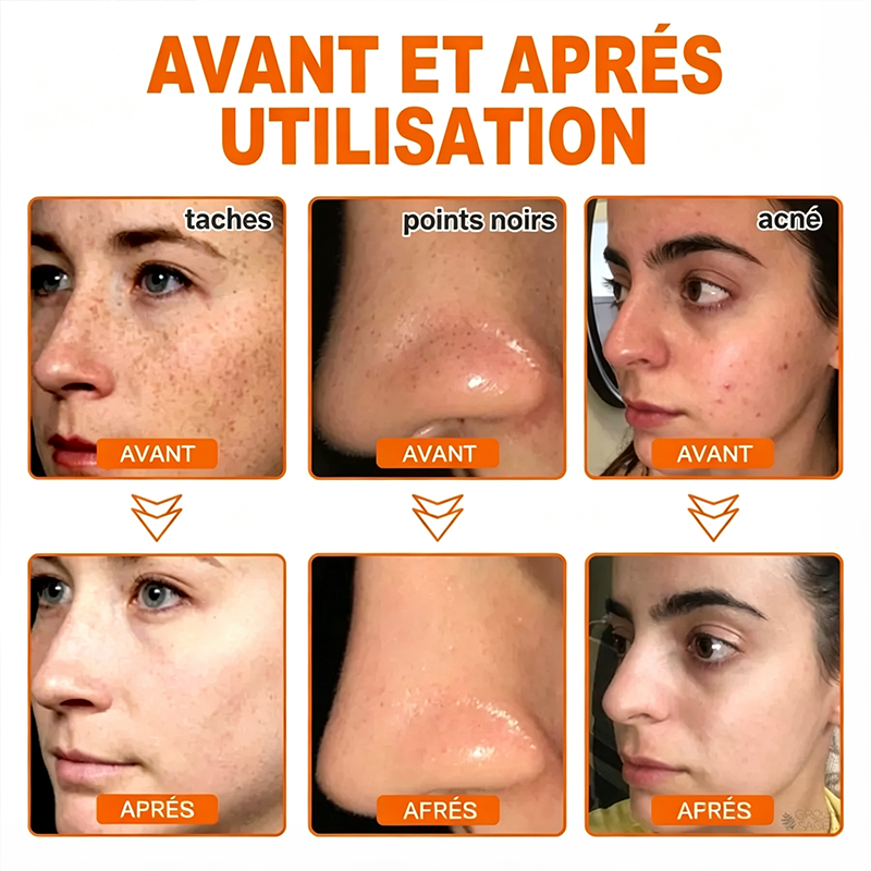 💖 2 achetés + 2 offerts – Masque visage peel-off aux plantes pour les imperfections