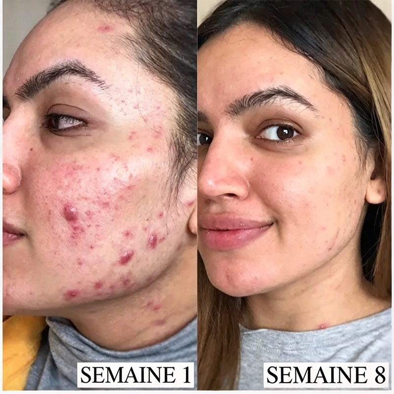 Masque visage peel-off enveloppant au collagène pour la nuit