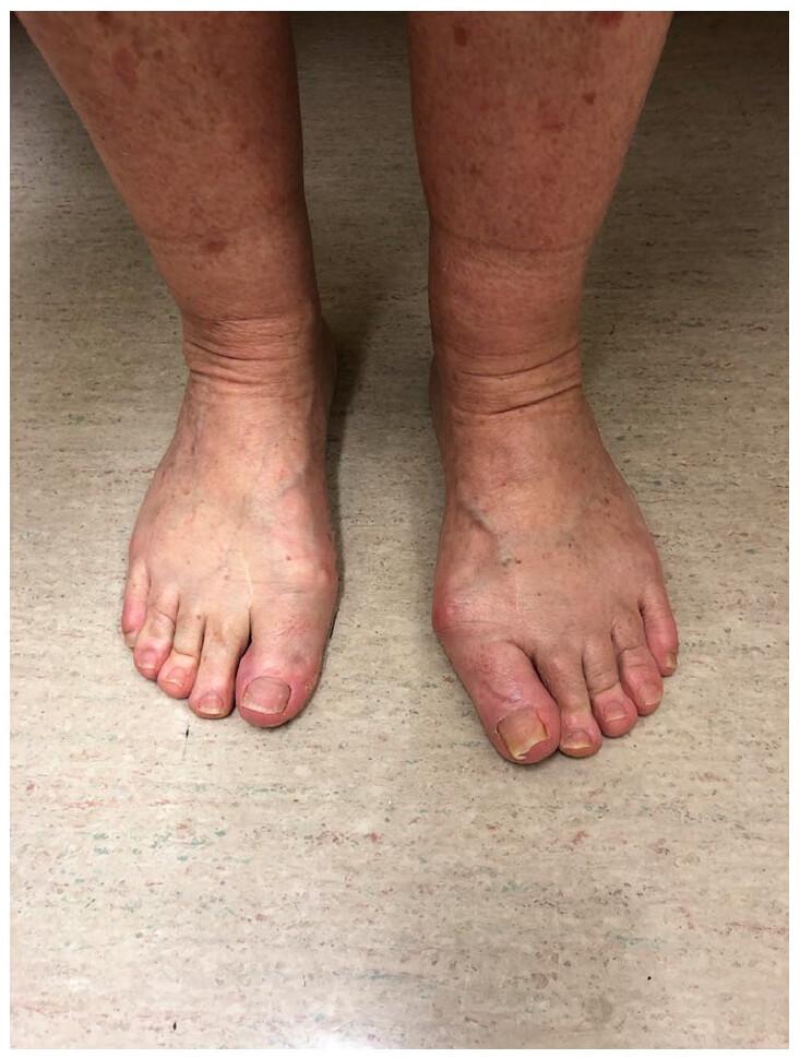 https://images.openai.com/static-rsc-4/7WBXwZJ4caNi0oiVCj51Bxskxfbq-QDITDhJFNLRcN9pkLdaSsLzWzW92KhSyMBc7qQuSKKb7BgkERkBcolhiDC8M41kToWJghOuD-kOlelQrmq9kTjfeGGJ3iStxmO5KxMvdYlu2RIF1UK9YY1_455ZzYPOcsOHxIy8Zoy-5vS2KSnBYwfrkdNpbk5ikpEx?purpose=fullsize