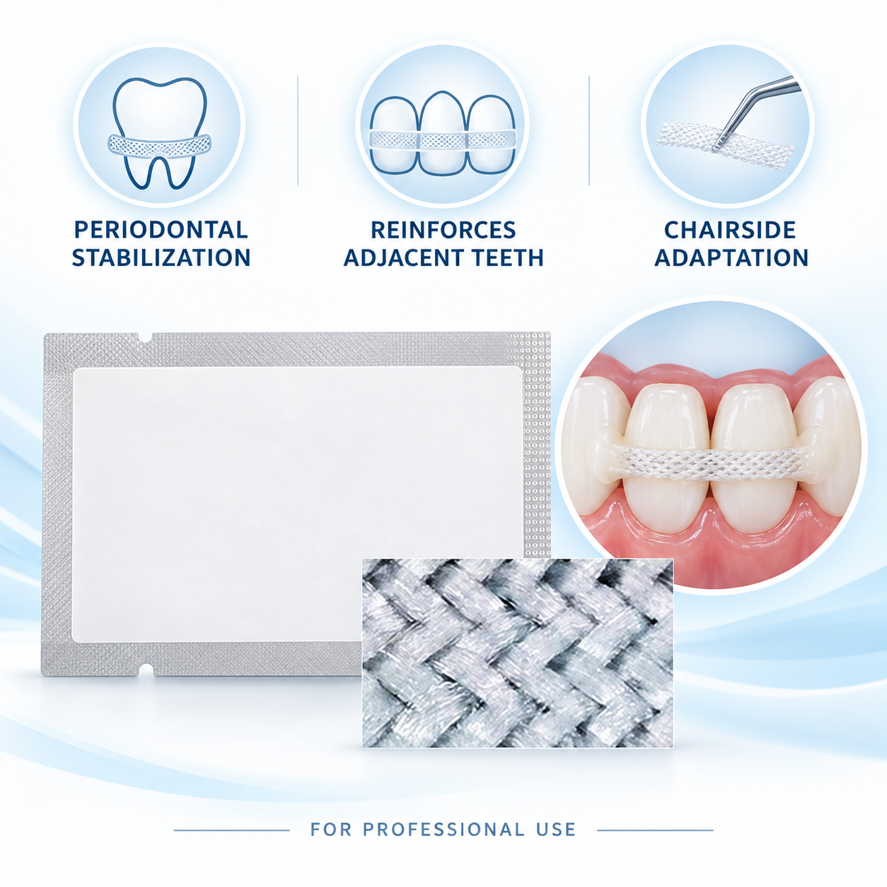 Dental Periodontal Splint Fiber