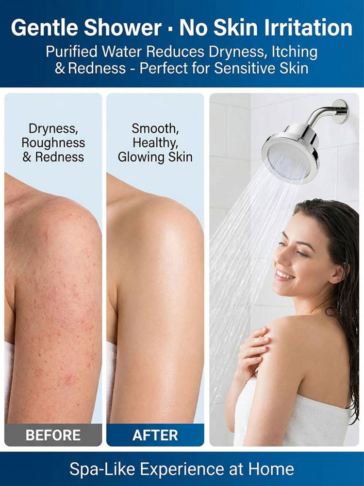 High-end German-made pressure-boosting shower head! Skin-care, pressure boosting, and water purification! Saves 60% on water bills compared to ordinary shower heads!