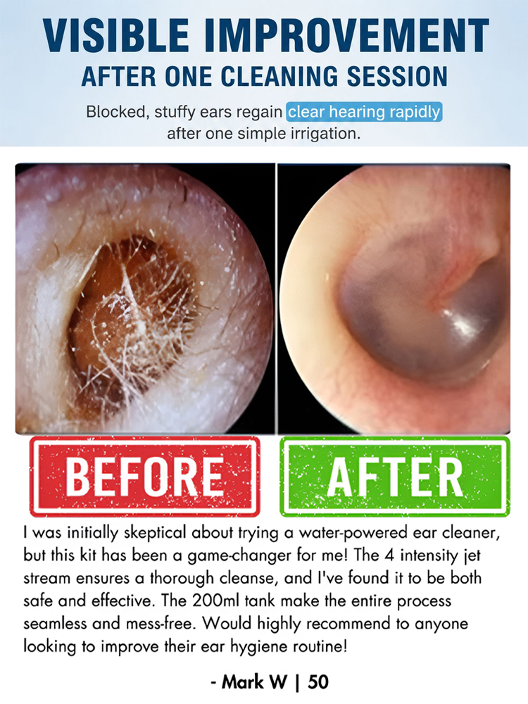 ENT-Approved Home Ear Irrigation Micro-Clinic System