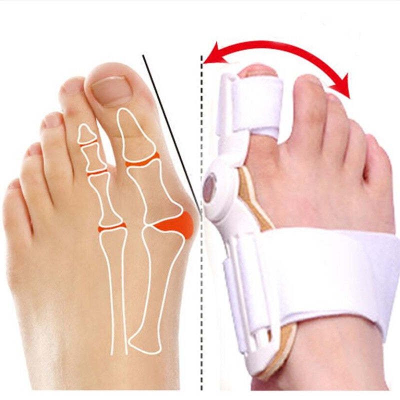 [Doctor Recommended] Bunion Corrector for Men & Women