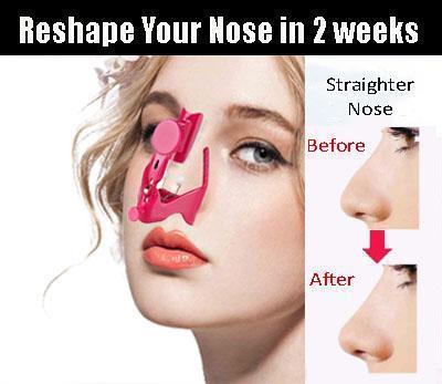 Electric Nose Lifter Device-xinru