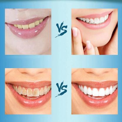 Natural Activated Charcoal Teeth Whitening Powder-xinru