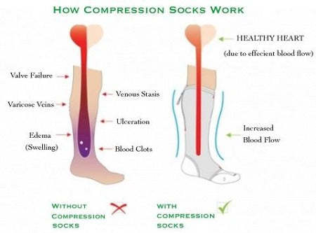 Gradient Compression Socks Knee High Support Stockings 9 Colors-xinru