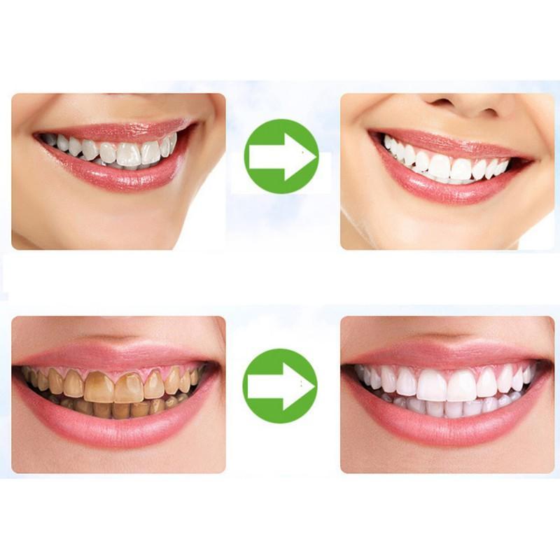 Natural Activated Charcoal Teeth Whitening Powder-xinru