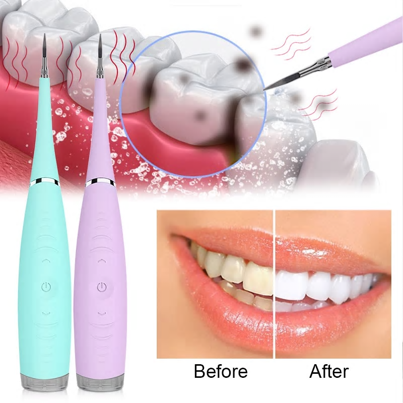 Ultrasonic Electric Tooth Cleaning Wand  Dental Calculus Remover-xinru