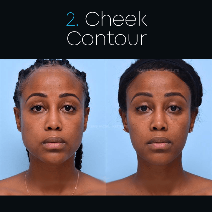 Anti-aging Anti-wrinkle Tape Ultrasonic Face Slimming Ring-xinru