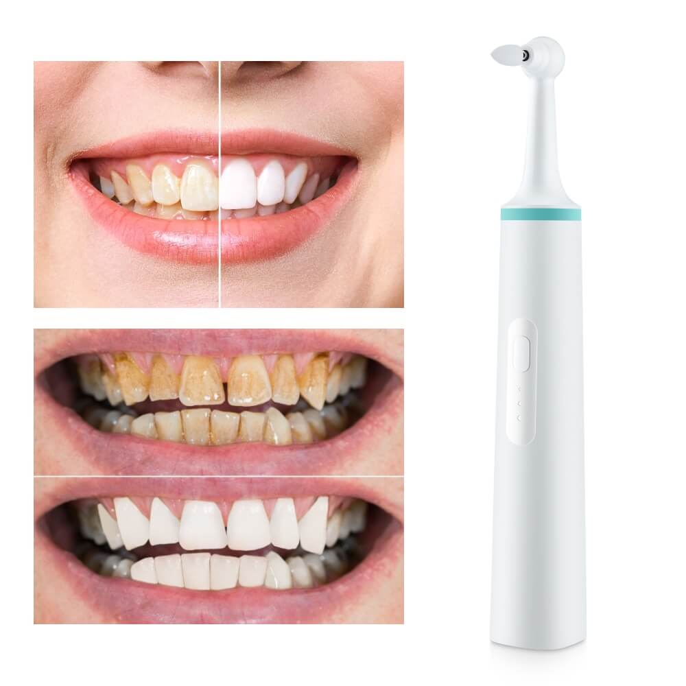 How To Remove Plaque From Teeth At Home