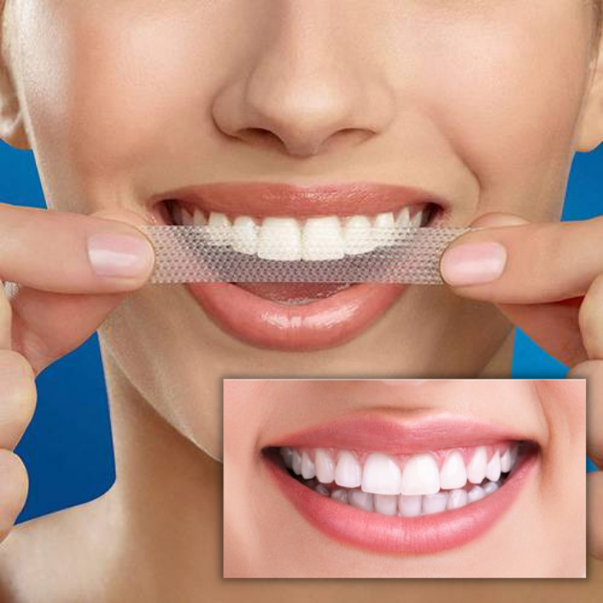 Professional Teeth Whitening Strips Bleaching Gel Dental Care Kit-xinru