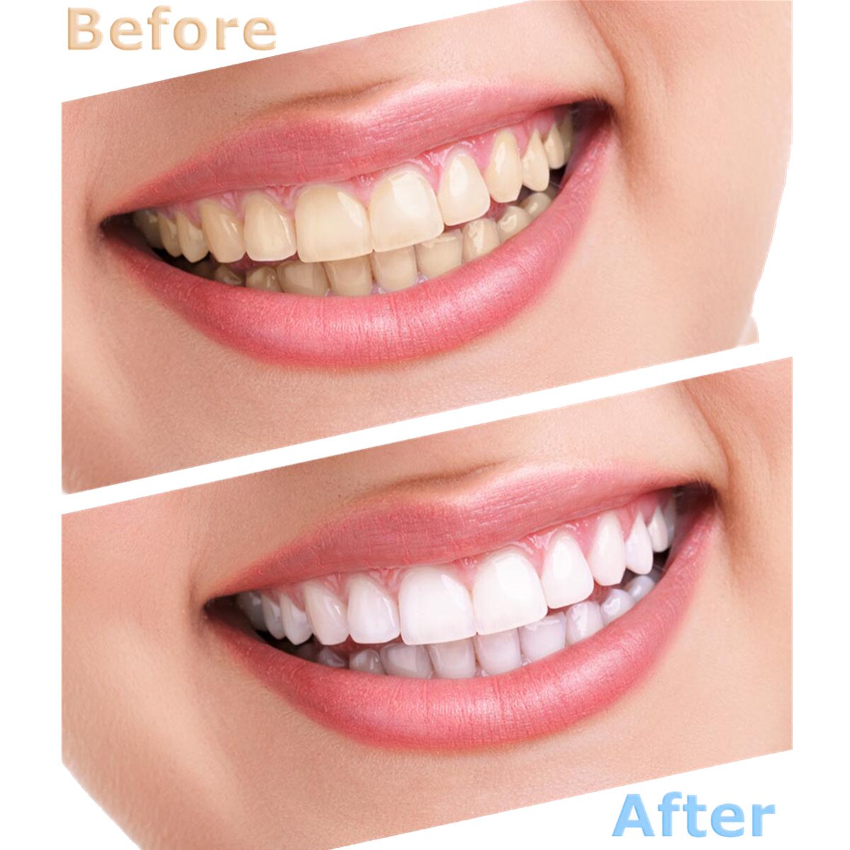 Sonic Tooth Stain Eraser And Plaque Remover-xinru