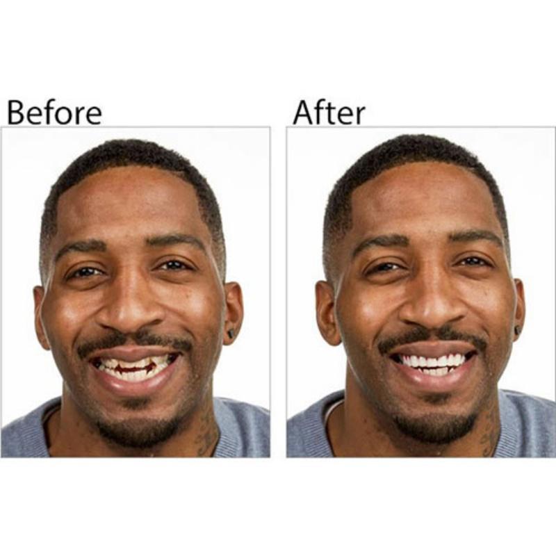 Smile Ready Cosmetic Fake Teeth-xinru