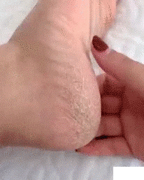 Moisturizing Socks with Gel Lining – UOnlyLife