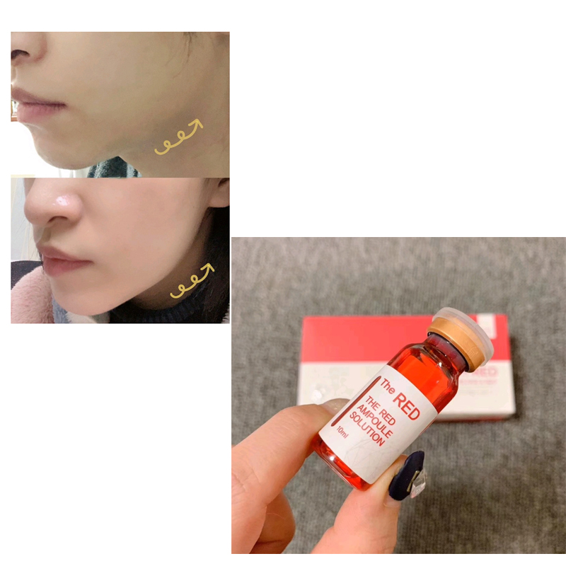 The Red Ampoule Fat Burning fat dissolve slimming Solution mesotherapy lipolab for double chin  arm use-iRENICE