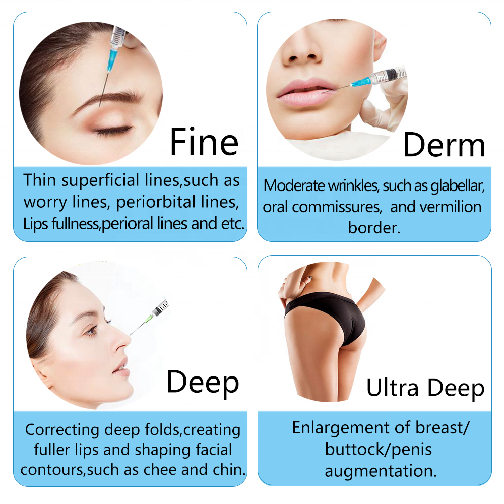 iRenice 1ml Cross Linked Hyaluronic Acid Buy Injectable Dermal Fillers-iRENICE