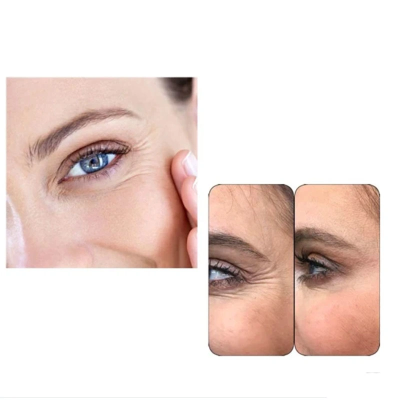 Mesotherapy Non Cross-Linked Sodium Hyaluronate Gel Dermal Filler Injection Beauty Salon Use Derma Pen Injection