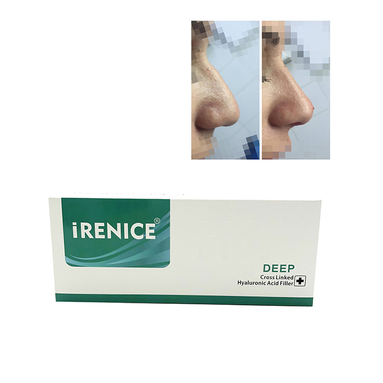 iRenice Hyaluronic acid face lifting injection anti wrinkles Deep folds filler dermal filler for nose up and face lift -iRENICE