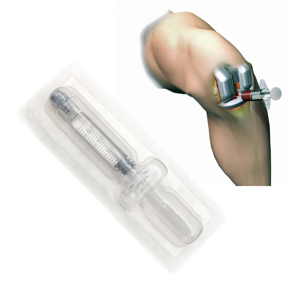Treating Knee Osteoarthritis with Hyaluronan Injection-iRENICE