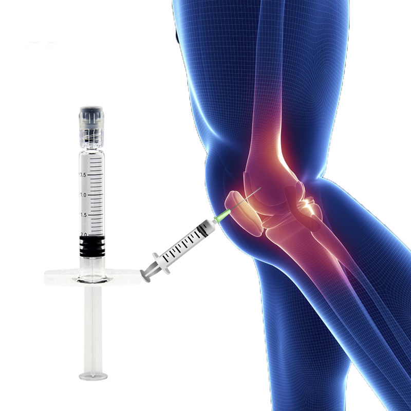 Treating Knee Osteoarthritis with Hyaluronan Injection