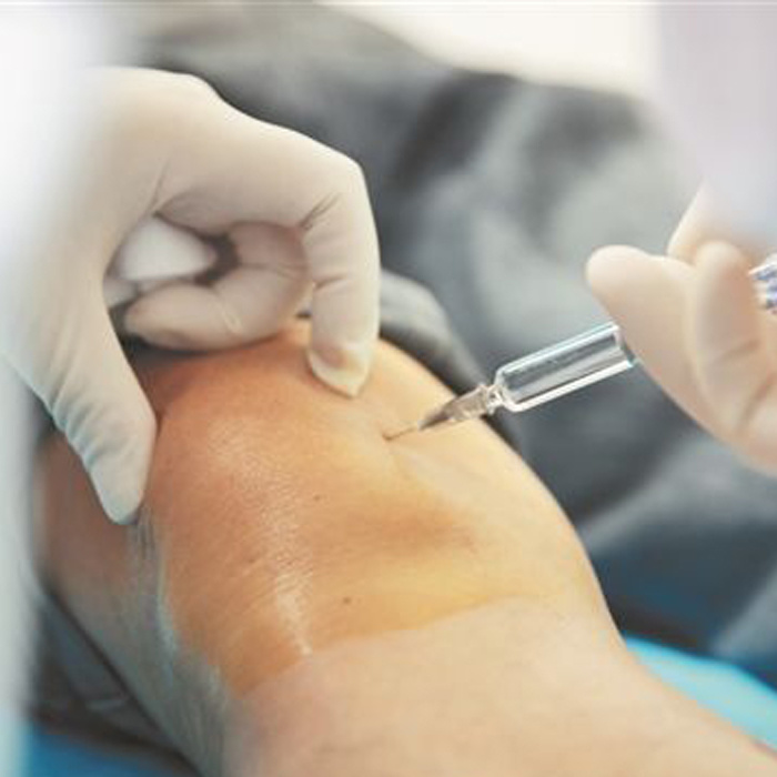 Treating Knee Osteoarthritis with Hyaluronan Injection-iRENICE