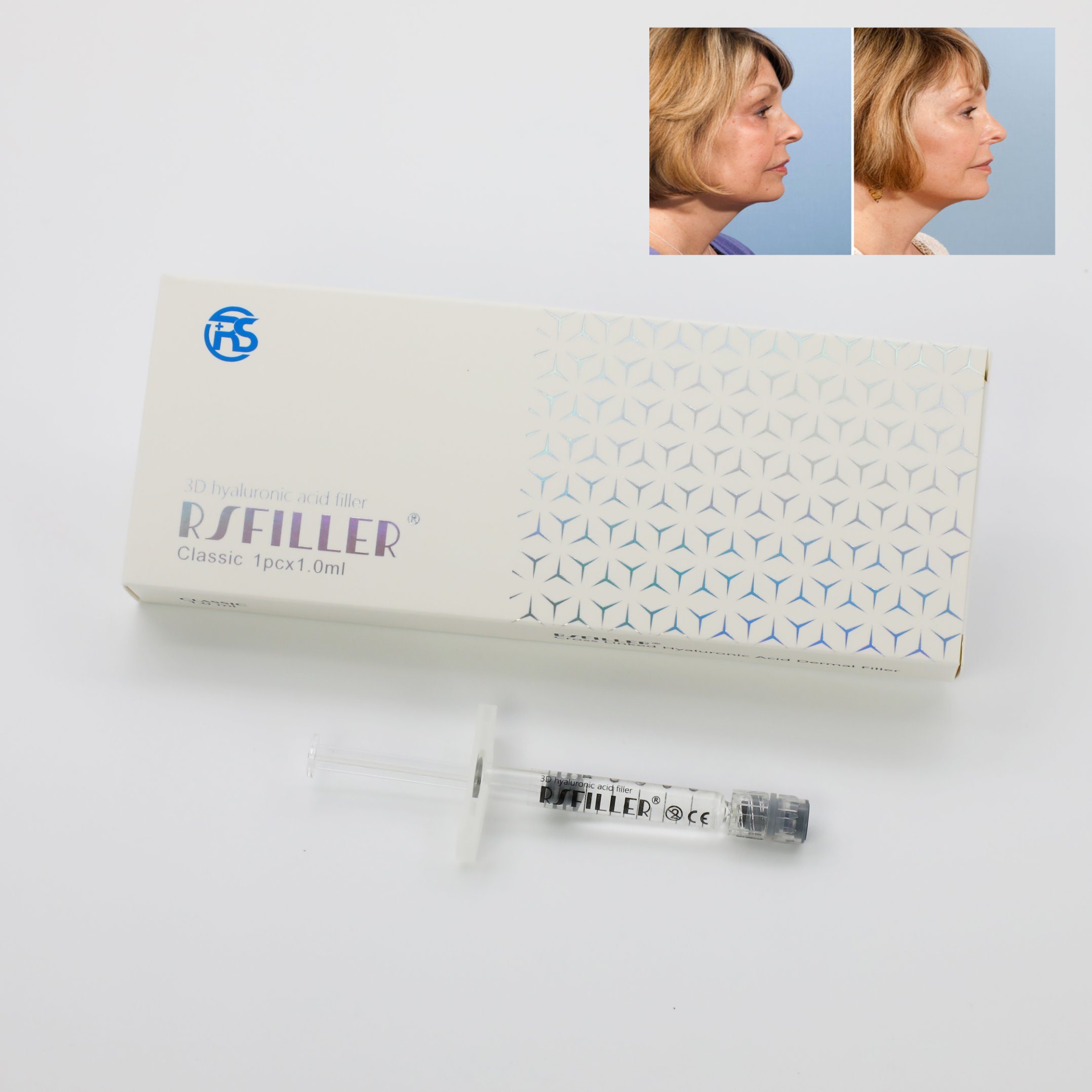 Professional Top Manufacturer 1ml Ha Injection Filler Hyaluronic Acid for Anti-Aging