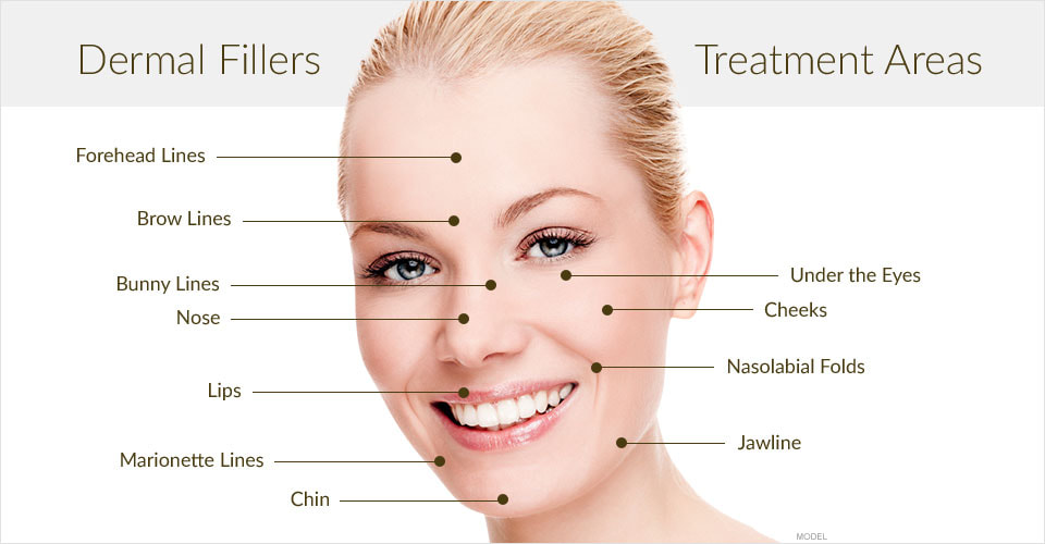 Dermal fillers: The good, the bad and the dangerous-iRENICE
