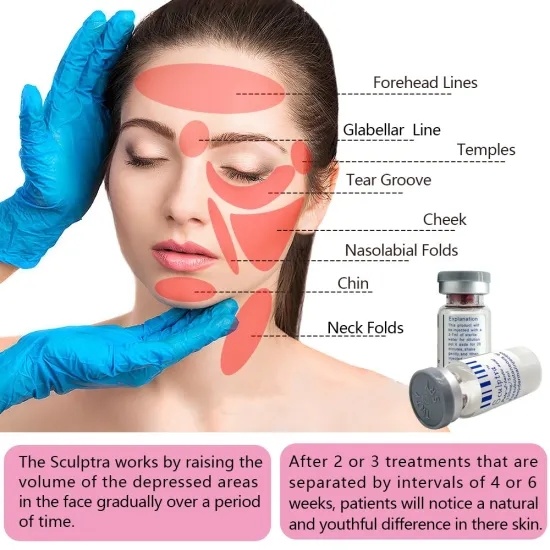 Collagen Booster Sculptra Reborn Poly-L-Lactic Acid for Neck and Chest Rejuvenation-iRENICE