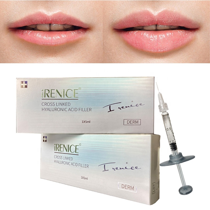 Buy hot sell iRENICE sodium hyaluronate injection hyaluronic acid dermal filler -iRENICE