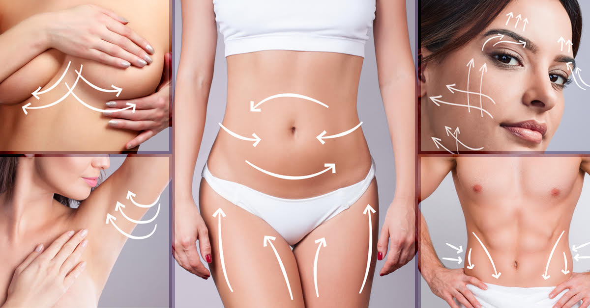 Body Contouring - YellowBlu MedSpa