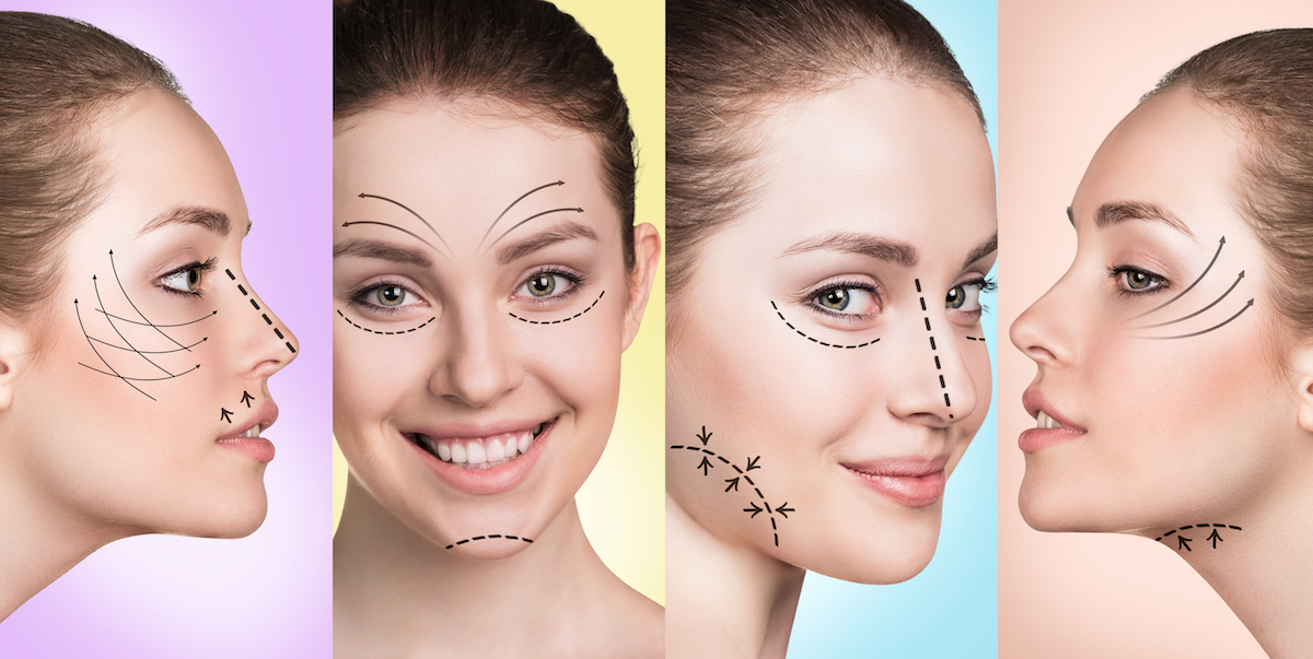 See the source image